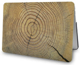 KECC Macbook Case with Cut Out Logo + Sleeve Package | Wood Collection - Cracked Wood