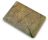 KECC Macbook Case with Cut Out Logo + Sleeve Package | Wood Collection - Cracked Wood