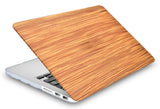 KECC Macbook Case with Cut Out Logo + Keyboard Cover and Screen Protector Package | Leather Collection - Wood Leather 1