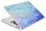 KECC Macbook Case with Cut Out Logo | Color Collection -   Blue - Water Paint 2