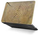 KECC Macbook Case with Cut Out Logo + Keyboard Cover Package | Cracked Wood