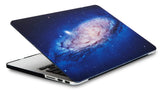 KECC Macbook Case with Cut Out Logo | Galaxy Space Collection - Milky Way