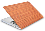 KECC Macbook Case with Cut Out Logo + Keyboard Cover and Screen Protector Package | Leather Collection - Wood Leather 32