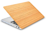 KECC Macbook Case with Cut Out Logo + Keyboard Cover and Screen Protector Package | Leather Collection - Wood Leather 6