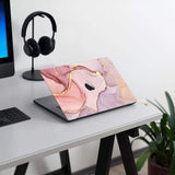 KECC Macbook Case with Keyboard Cover Package | 1Pink gold