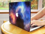 Macbook Case | Galaxy Space Collection - Galaxy - Case Kool