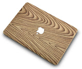 Macbook Case | Leather Collection - Pine Wood 1 - Case Kool