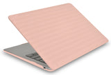KECC Macbook Case with Cut Out Logo + Keyboard Cover | Color Collection - Baby Pink Luggage