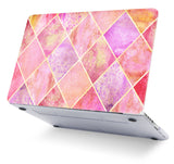 KECC Macbook Case with Cut Out Logo + Keyboard Cover Package |Pink Diamond